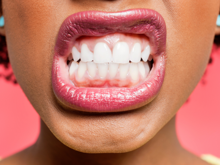 7 tips för vita tänder (Så får du friska tänder HELA livet)